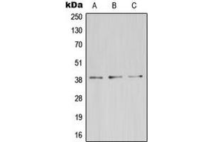 Western blot analysis of ZDHHC9 expression in HeLa (A), mouse kidney (B), rat brain (C) whole cell lysates. (ZDHHC9 Antikörper  (C-Term))