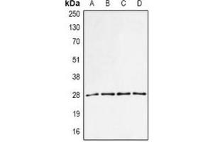 Western blot analysis of PA28 alpha expression in MCF7 (A), BT474 (B), mouse spleen (C), mouse liver (D) whole cell lysates. (PSME1 Antikörper)