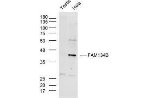 Lane 1: Mouse testis lysates, Lane 2: Hela lysates probed with FAM134B Polyclonal Antibody, Unconjugated  at 1:300 overnight at 4˚C. (FAM134B Antikörper  (AA 210-310))