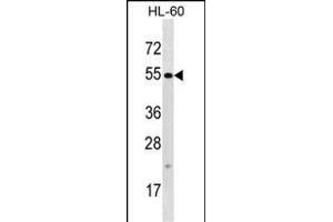 TTC34 Antibody (C-term) (ABIN1537441 and ABIN2848517) western blot analysis in HL-60 cell line lysates (35 μg/lane). (TTC34 Antikörper  (C-Term))