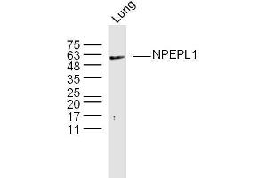 Mouse lung lysates probed with NPEPL1 Polyclonal Antibody, Unconjugated  at 1:300 overnight at 4˚C.