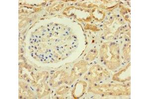 Immunohistochemistry of paraffin-embedded human kidney tissue using ABIN7176159 at dilution of 1:100 (ZNF221 Antikörper  (AA 1-300))
