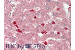 IHC-P analysis of Human Liver Tissue, with HE staining. (CHI3L1 Antikörper  (AA 112-377))