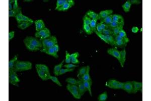 Immunofluorescence (IF) image for anti-Protein Kinase, Interferon-Inducible Double Stranded RNA Dependent Activator (PRKRA) (AA 1-313) antibody (ABIN7156699)