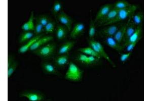 Immunofluorescence staining of HepG2 cells with ABIN7144729 at 1:166, counter-stained with DAPI. (GOT1 Antikörper  (AA 2-411))
