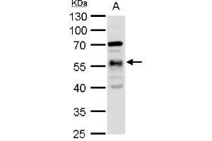 WB Image alpha Tubulin 1A antibody detects alpha Tubulin 1A protein by western blot analysis. (TUBA1A Antikörper)