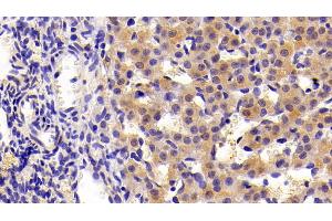 Immunohistochemistry (IHC) image for anti-Keratin 7 (KRT7) (AA 394-457) antibody (ABIN7437020)