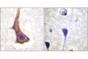 Immunohistochemistry analysis of paraffin-embedded human brain tissue, using CSFR (Ab-561) Antibody. (CSF1R Antikörper  (AA 531-580))