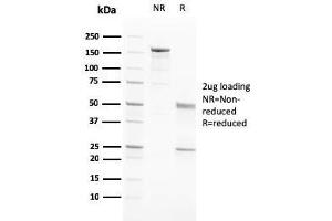 SDS-PAGE Analysis Purified PAPP-A Mouse Monoclonal Antibody (PAPPA/2717). (PAPPA Antikörper  (AA 351-523))