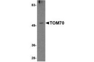 Image no. 1 for anti-Translocase of Outer Mitochondrial Membrane 70 (TOMM70A) (N-Term) antibody (ABIN341709) (TOM70 Antikörper  (N-Term))
