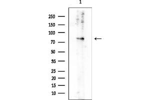 Western blot analysis of lysates from Rat heart, using DRP1 Mouse Monoclonal Antibody at 1/1000 dilution.