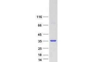 Validation with Western Blot