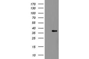 Image no. 5 for anti-Replication Factor C (Activator 1) 2, 40kDa (RFC2) (AA 1-234) antibody (ABIN1490618) (RFC2 Antikörper  (AA 1-234))