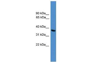 WB Suggested Anti-UCHL5 Antibody Titration: 0. (UCHL5 Antikörper  (C-Term))