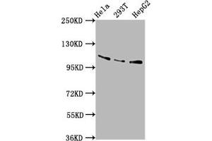 Western Blot Positive WB detected in: Hela whole cell lysate, 293T whole cell lysate, HepG2 whole cell lysate All lanes: AASS antibody at 5. (AASS Antikörper  (AA 224-364))