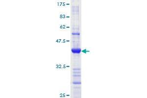 Image no. 1 for MutL Homolog 1 (MLH1) (AA 647-756) protein (GST tag) (ABIN1311006)