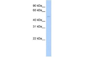 WB Suggested Anti-Pias2 Antibody Titration:  0. (PIAS2 Antikörper  (C-Term))