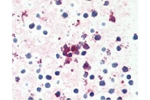 Image no. 1 for anti-Chemokine (C-C Motif) Receptor 4 (CCR4) (C-Term) antibody (ABIN488046) (CCR4 Antikörper  (C-Term))