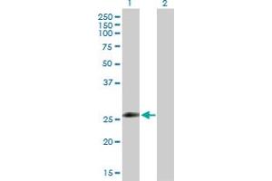Western Blot analysis of ZNF266 expression in transfected 293T cell line by ZNF266 MaxPab polyclonal antibody. (ZNF266 Antikörper  (AA 1-263))