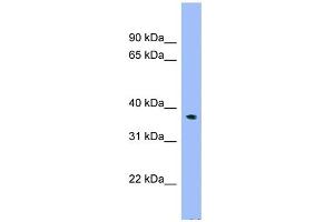 WB Suggested Anti-C17orf48 Antibody Titration: 0. (ADPRM Antikörper  (N-Term))