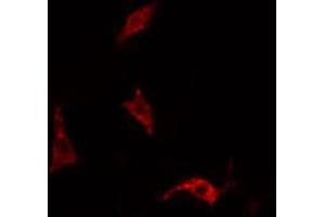 ABIN6266468 staining HepG2 cells by IF/ICC. (EPS15 Antikörper  (pTyr849))