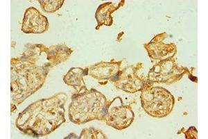 Immunohistochemistry of paraffin-embedded human placenta tissue using ABIN7145226 at dilution of 1:100 (BAG5 Antikörper  (AA 198-447))