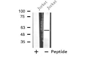 Western blot analysis of extracts from Jurkat cells, using MATK antibody. (MATK Antikörper  (Internal Region))