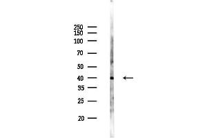 anti-Prenyl (Decaprenyl) Diphosphate Synthase, Subunit 2 (PDSS2) (C-Term) antibody