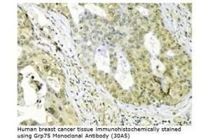 Image no. 1 for anti-Heat Shock 70kDa Protein 9 (Mortalin) (HSPA9) antibody (ABIN364088)