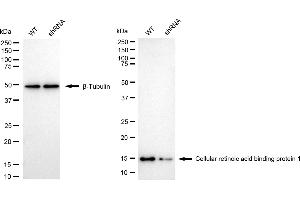 anti-Cellular Retinoic Acid Binding Protein 1 (CRABP1) antibody