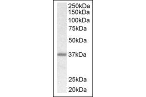 Image no. 1 for anti-Biglycan (BGN) (C-Term) antibody (ABIN375174) (Biglycan Antikörper  (C-Term))