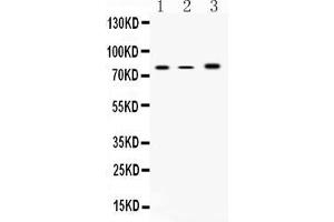 Western blot analysis of 12 Lipoxygenase using anti-12 Lipoxygenase antibody .