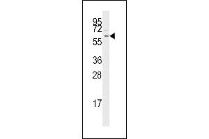 Western Blotting (WB) image for anti-Transforming Growth Factor, beta Receptor 1 (TGFBR1) (AA 134-163) antibody (ABIN392279)
