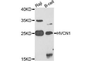 Western blot analysis of extracts of various cells, using HVCN1 antibody. (HVCN1 Antikörper)
