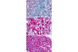 Immunohistochemical staining of formalin-fixed paraffin-embedded human tonsil (A), adrenal gland (B) and testis (C) with CELSR1 polyclonal antibody . (CELSR1 Antikörper  (C-Term))