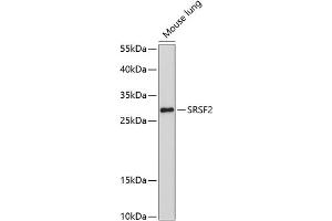 Western blot analysis of extracts of mouse lung, using SRSF2 antibody (ABIN1682677, ABIN3017915, ABIN3017916, ABIN5664377 and ABIN6220303) at 1:1000 dilution. (SRSF2 Antikörper  (AA 1-75))