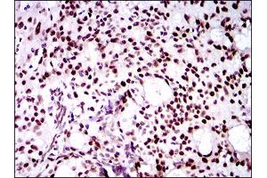 Immunohistochemistry (IHC) image for anti-Twist Homolog 1 (Drosophila) (TWIST1) (AA 9-74) antibody (ABIN1724845)