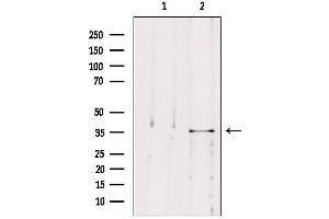 Western blot analysis of extracts from B16F10, using MAST4 Antibody. (MAST4 Antikörper  (N-Term))