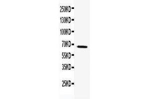 Anti-TRAF5 antibody, Western blotting WB: k562 Cell Lysate