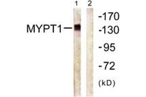 Western blot analysis of extracts from COS7 cells, using MYPT1 (Ab-696) Antibody. (PPP1R12A Antikörper  (AA 661-710))