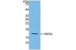 Detection of Recombinant IFNg, Rat using Polyclonal Antibody to Interferon Gamma (IFNg) (Interferon gamma Antikörper  (AA 23-156))