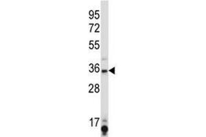 SIRT6 antibody western blot analysis in K562 lysate. (SIRT6 Antikörper  (AA 276-305))