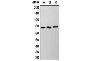Western blot analysis of NDUFS1 expression in HeLa (A), SP2/0 (B), PC12 (C) whole cell lysates. (NDUFS1 Antikörper  (C-Term))
