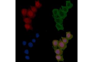 ABIN6255486 and ABIN6277780 staining Hela cells(30 min of UV treatment) by IF/ICC. (PKC epsilon Antikörper  (pSer729))