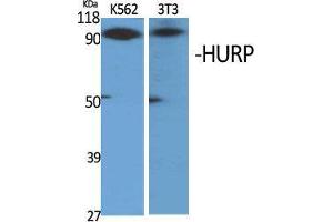 Western Blot (WB) analysis of specific cells using HURP Polyclonal Antibody.
