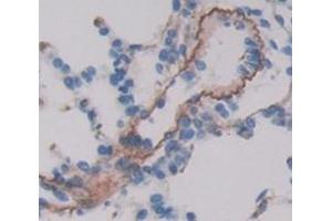 IHC-P analysis of Kidney tissue, with DAB staining. (VIPR1 Antikörper  (AA 34-146))