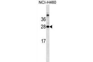 Western Blotting (WB) image for anti-Galectin 3 (LGALS3) antibody (ABIN2995387) (Galectin 3 Antikörper)