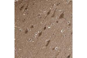 Immunohistochemical staining of human cerebral cortex with YWHAQ polyclonal antibody  shows strong cytoplasmic positivity in neuronal cells and glial cells. (YWHAB Antikörper)