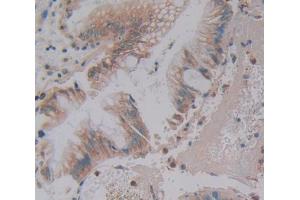 Used in DAB staining on fromalin fixed paraffin- embedded Kidney tissue (Phospholipase C beta 3, Phosphoinositide Specific (AA 318-468) Antikörper)