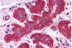 Human Breast: Formalin-Fixed, Paraffin-Embedded (FFPE) (JUP Antikörper  (AA 1-746))